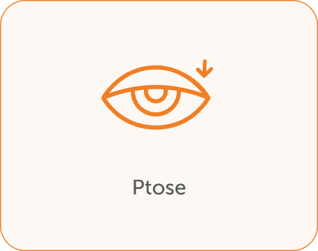 Ptose